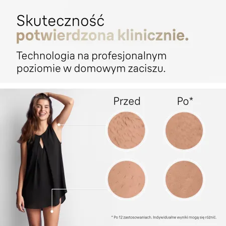 Depilator BRAUN Silk-expert Pro 5 OPIS!